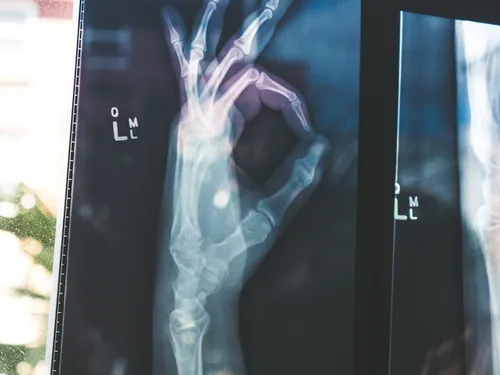 Software as a Medical Device (SaMD) under the MDR