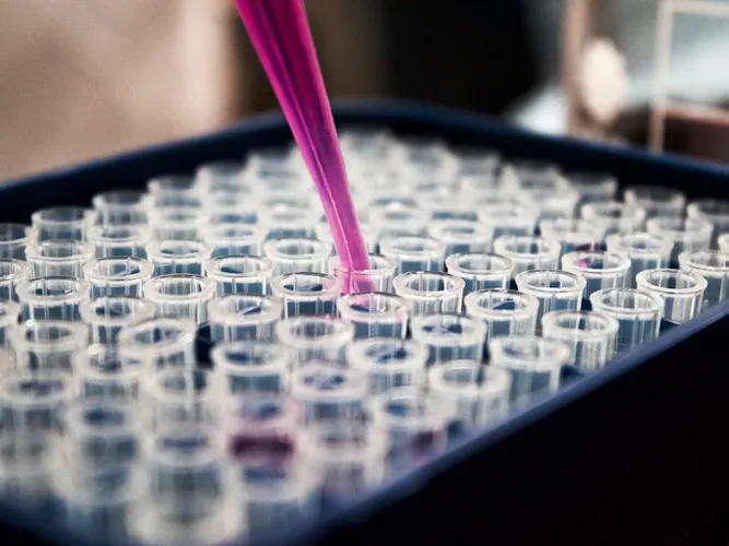 Pharmaceutical research in the lab – drug discovery and analysis